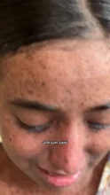 مأساة طفلة في غزة.. ميس القدرة تحاصرها الشمس والحرب وكلمات الناس والمرض (صورة + فيديو)