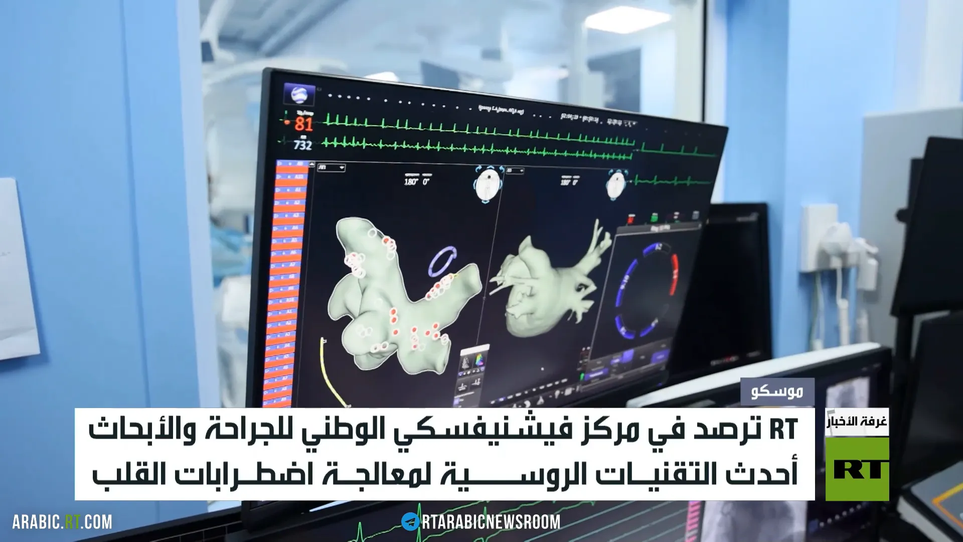 موسكو.. تقنيات متقدمة لعلاج أمراض القلب
