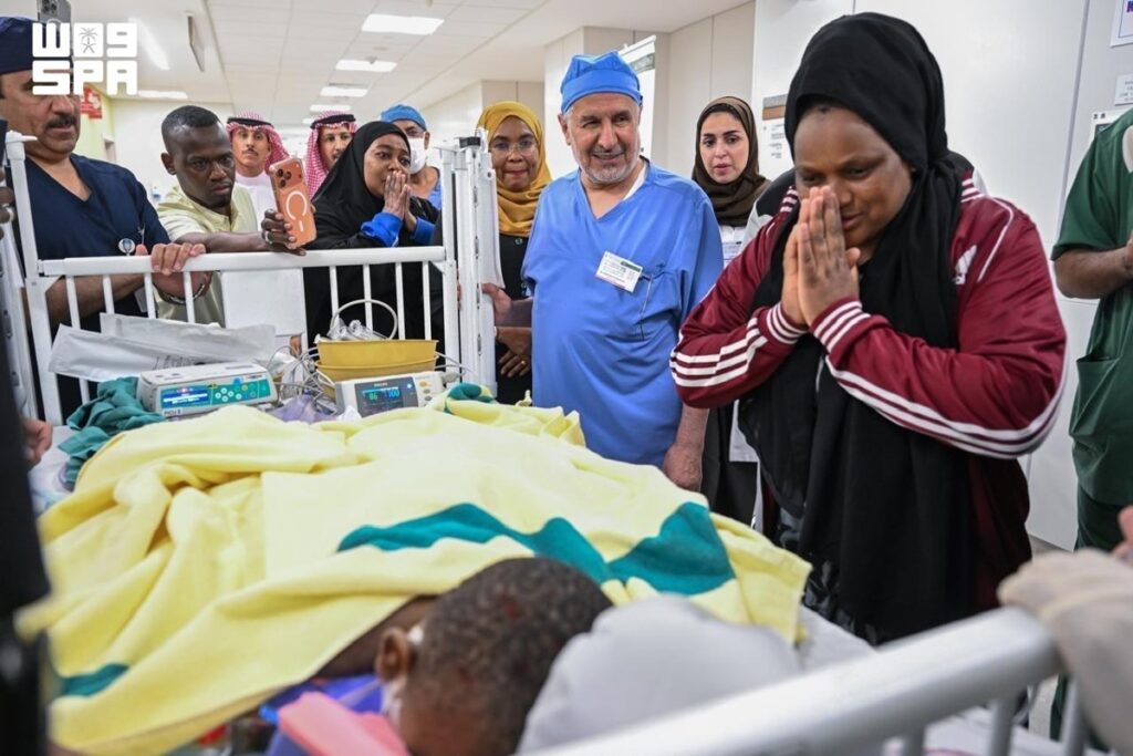 نجاح فصل التوأم الملتصق التنزاني لايتيينس ولوفنس في الرياض